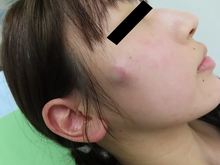 術前