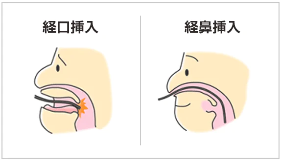 1.「オエッ」となりにくい