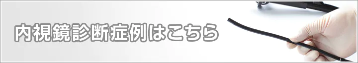 内視鏡診断症例