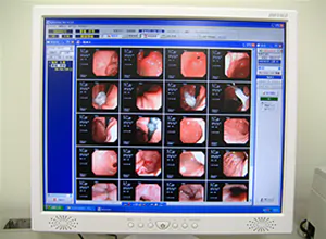 過敏性腸症候群とは